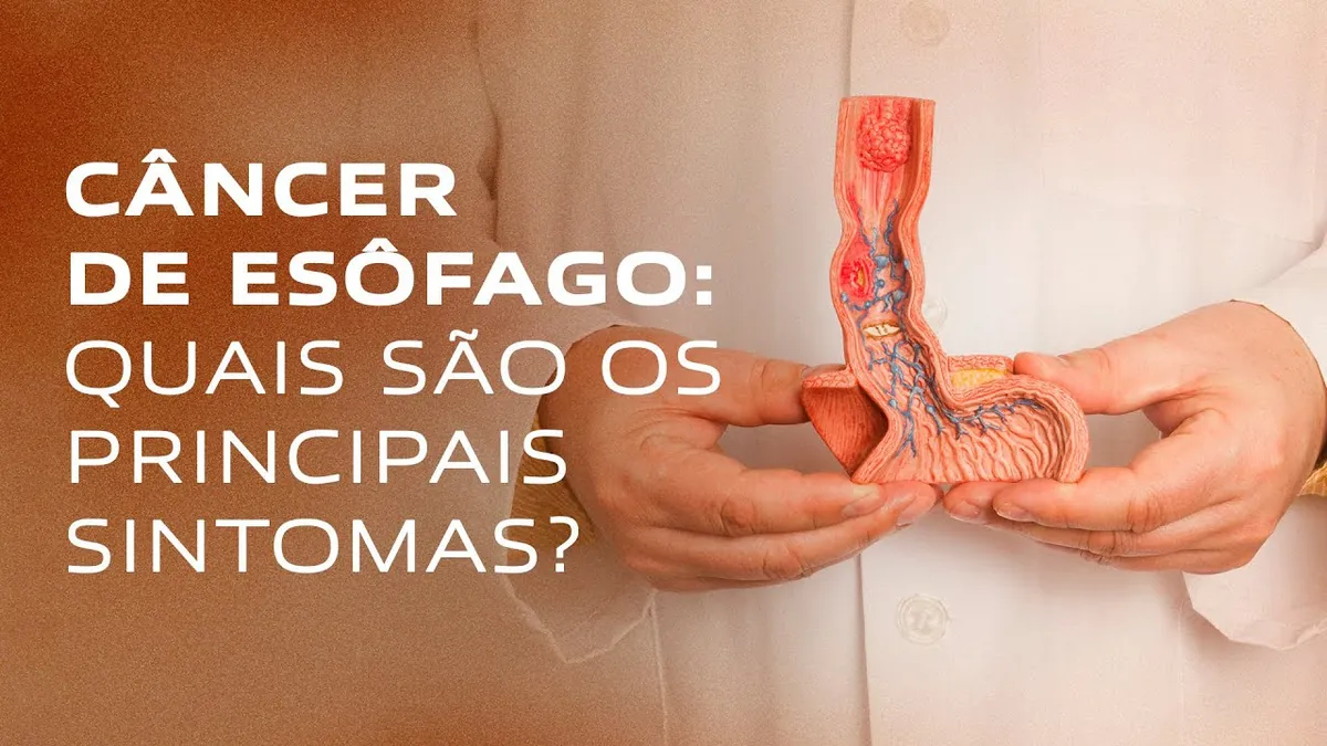Câncer de Esôfago: 7 Sintomas, Fatores de Risco e Diagnóstico Precoce