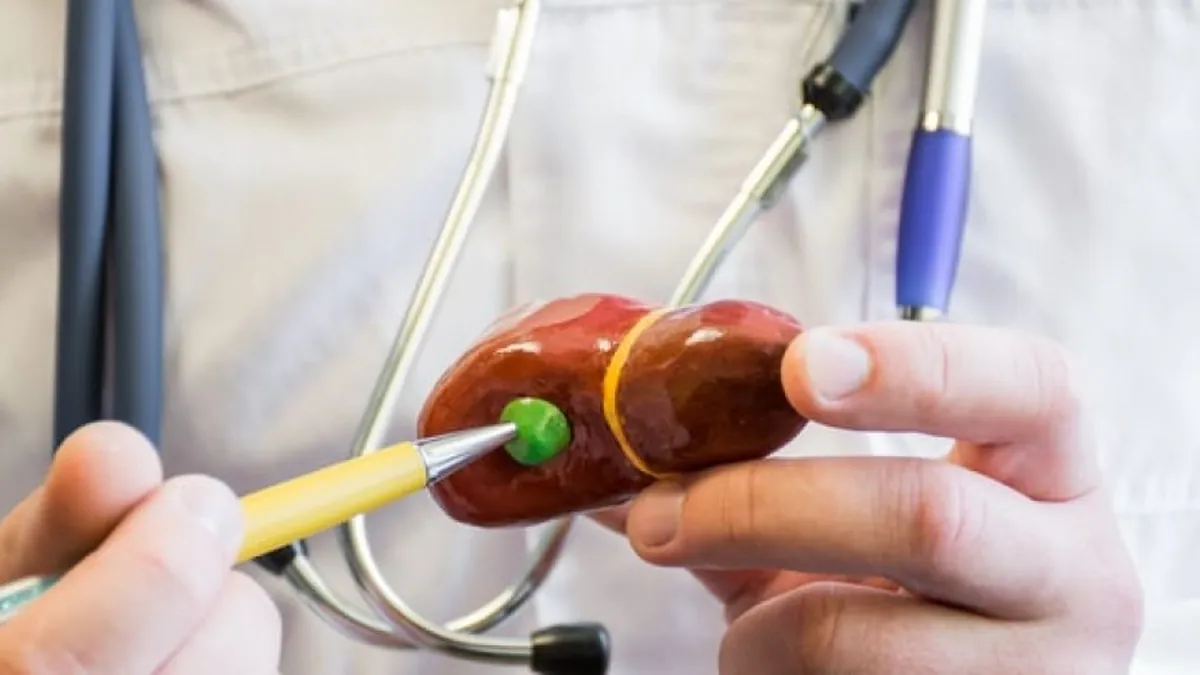 Cirurgia da Vesícula Biliar
