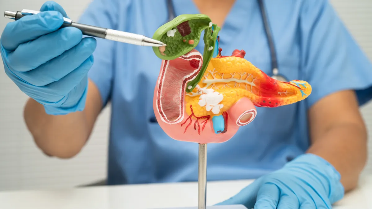Colangite: 6 Sintomas, Causas e Tratamento da Infecção Biliar
