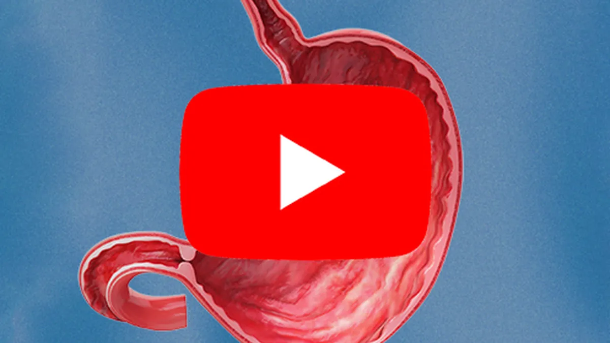 Como funciona o procedimento de Gastroplastia Endoscópica?
