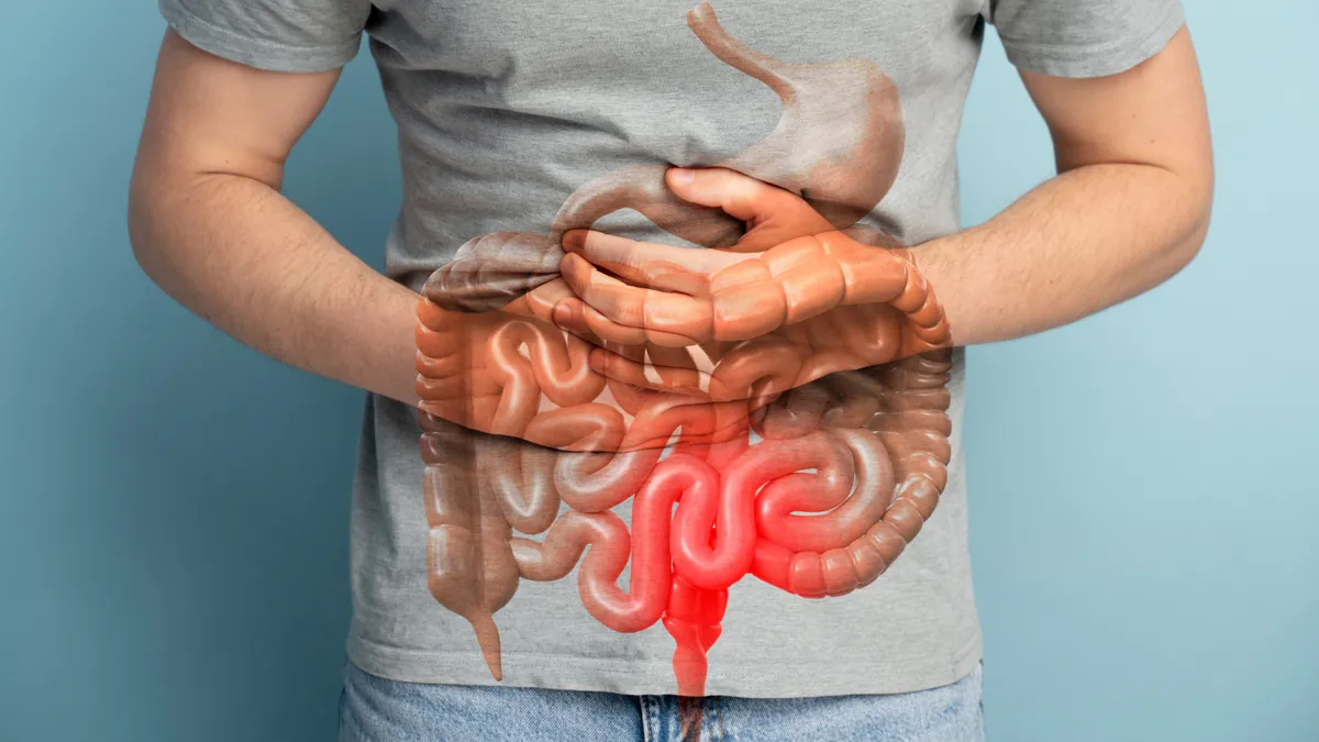 Diverticulite: 7 Sintomas, Causas e Tratamentos da Inflamação Intestinal