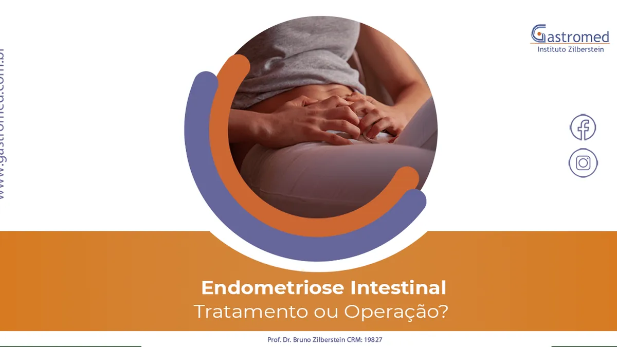 Endometriose Intestinal: Tratamento ou Operação?