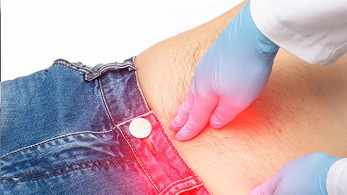 Hérnia inguinal é grave? Como funciona o tratamento?