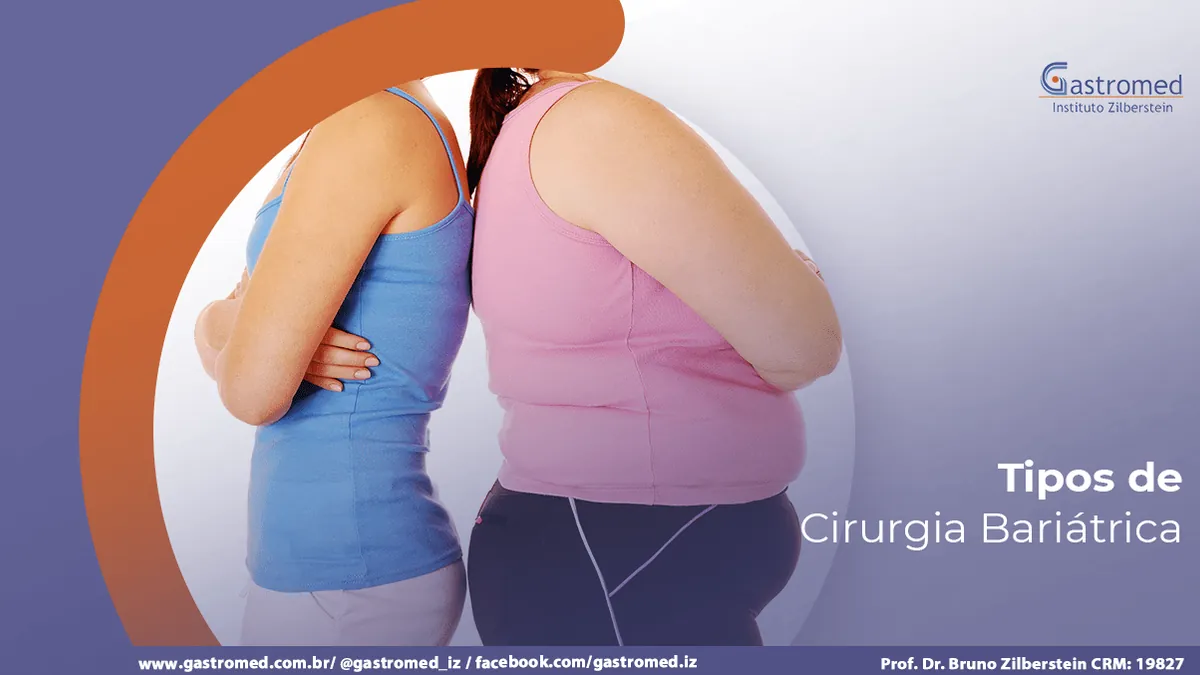 Tipos de bariátrica